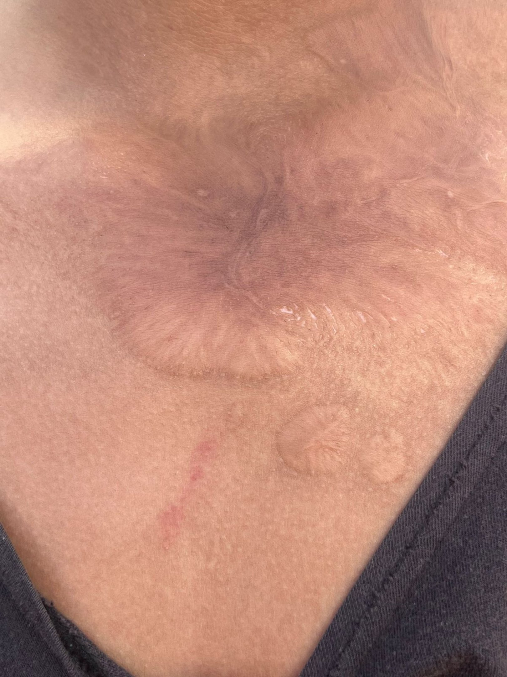 O adolescente sofria agressões constantes, com socos, chutes e mordidas