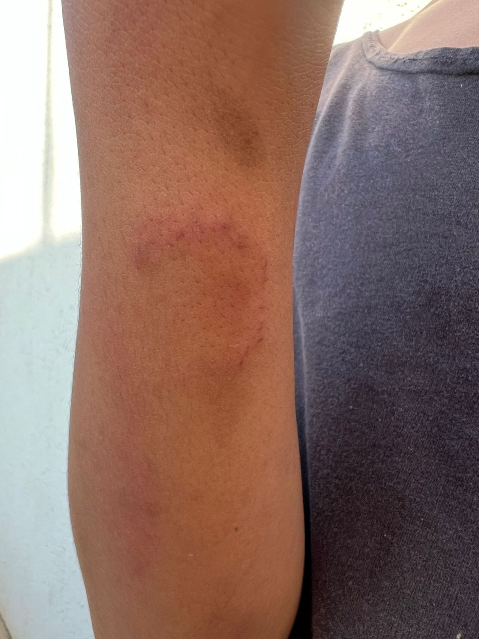 O adolescente sofria agressões constantes, com socos, chutes e mordidas