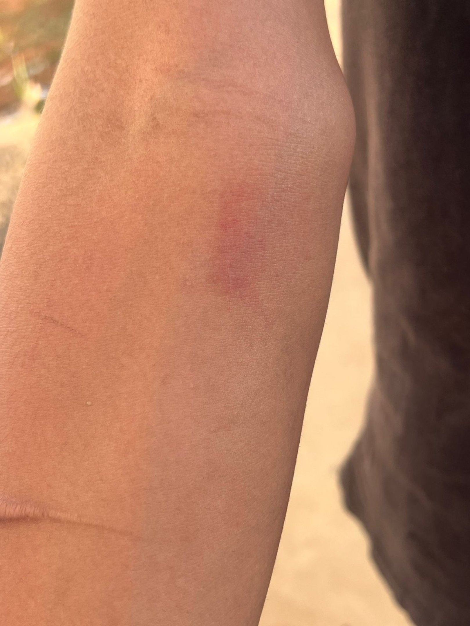 O adolescente sofria agressões constantes, com socos, chutes e mordidas