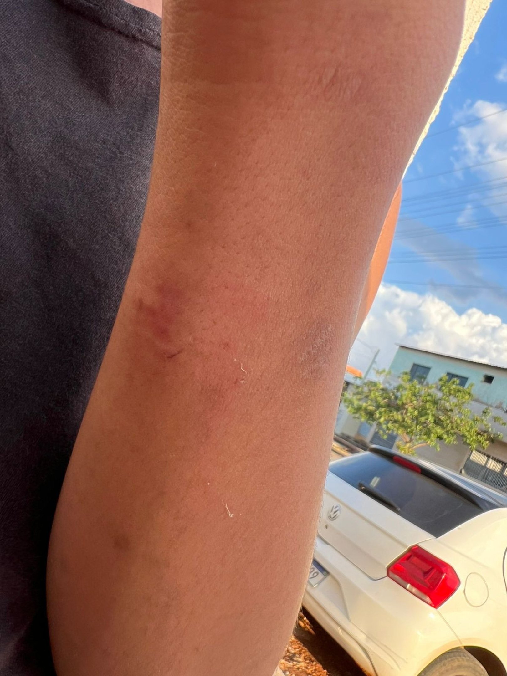 O adolescente sofria agressões constantes, com socos, chutes e mordidas