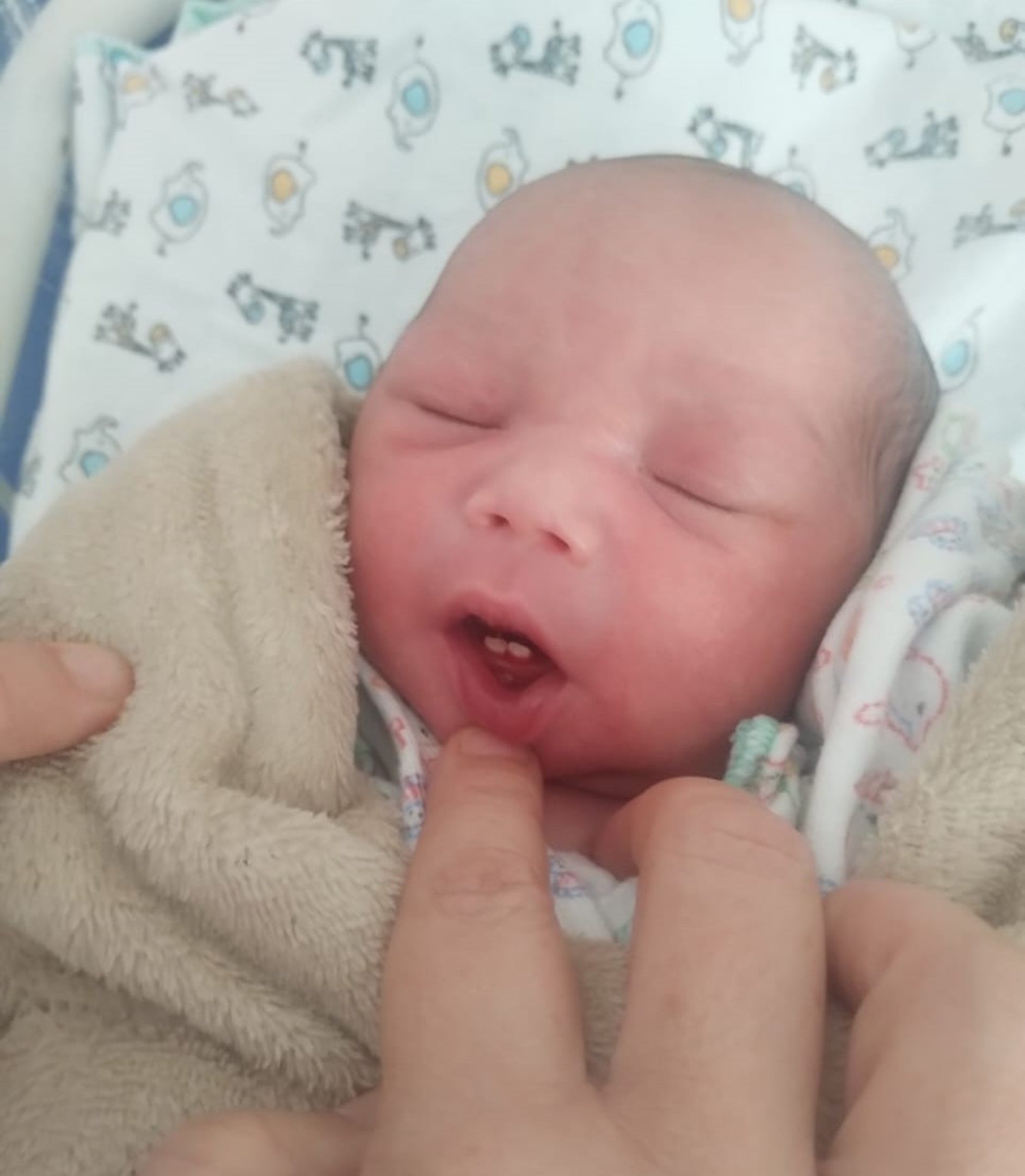 Os dois dentinhos extraídos foram guardados pela família como lembrança do nascimento inusitado de Yan Matteo.