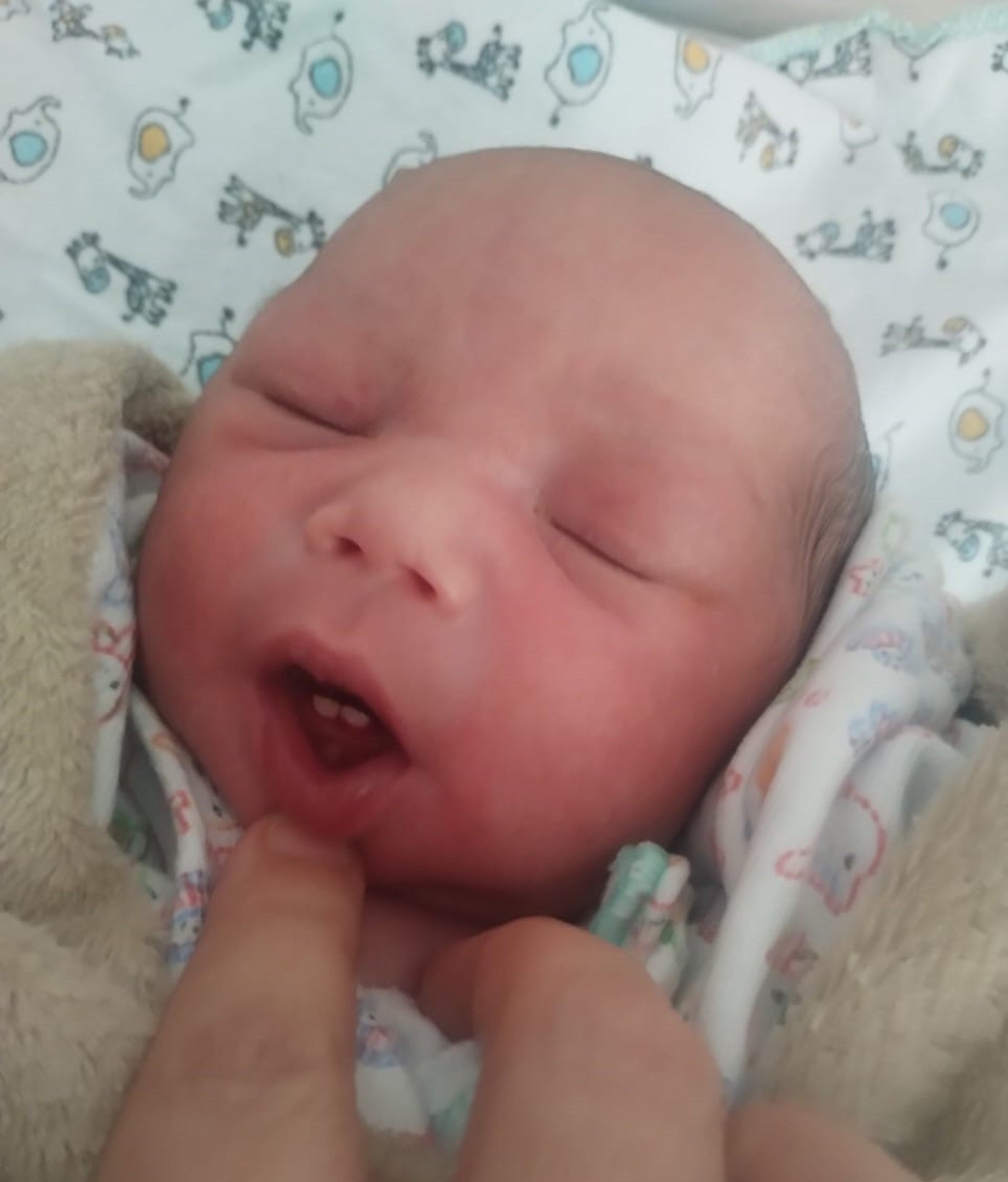 Yan Matteo nasceu com dois dentinhos, que logo foram extraídos