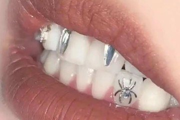 Tatuagem dentária vira moda na China -  (crédito: Reprodução)