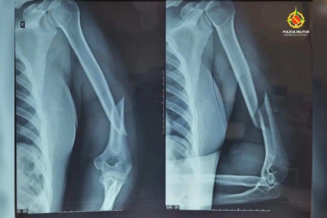 Mulher foi socorrida e levada ao Hospital Regional de Taguatinga (HRT) -  (crédito: Divulgação/PMDF)