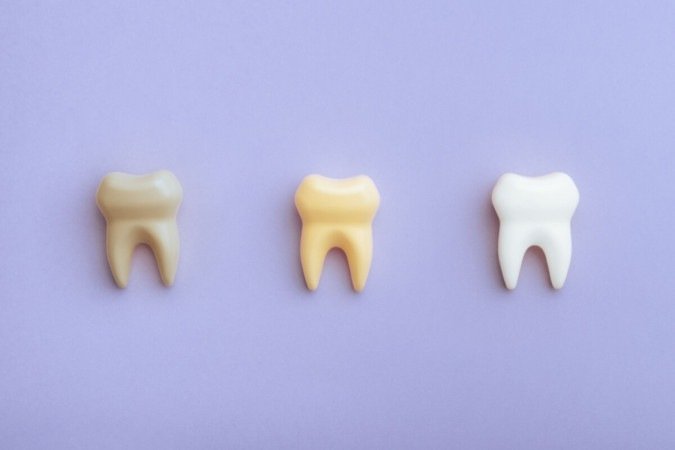 A alimentação e os hábitos diários estão entre os principais fatores que influenciam a cor dos dentes (Imagem: Nicoleta Ionescu | Shutterstock) -  (crédito: EdiCase)