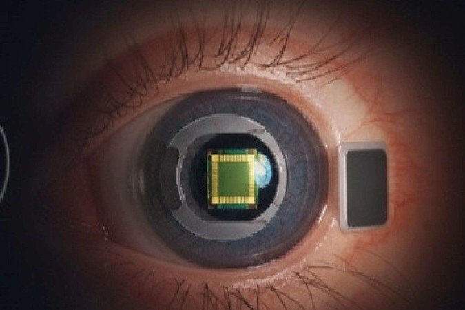 Chip ocular devolve leitura a pacientes com cegueira parcial