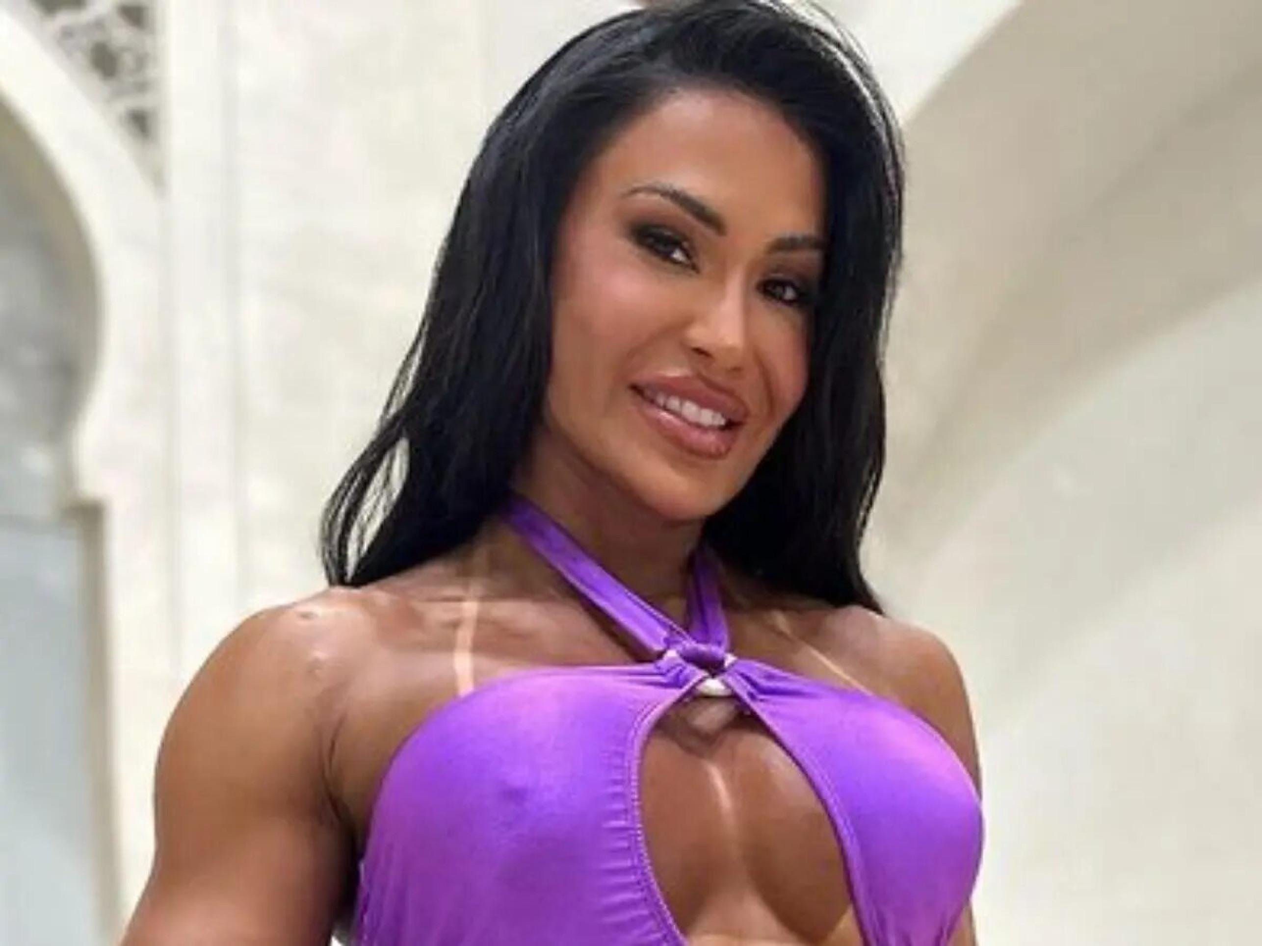 Gracyanne Barbosa relata lentidão no processo de recuperação: 