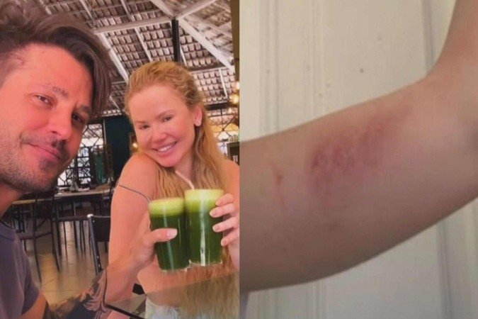 Miss Gramado foi coagida por Dado Dolabella a mentir sobre agressões -  (crédito: Reprodução/Instagram)