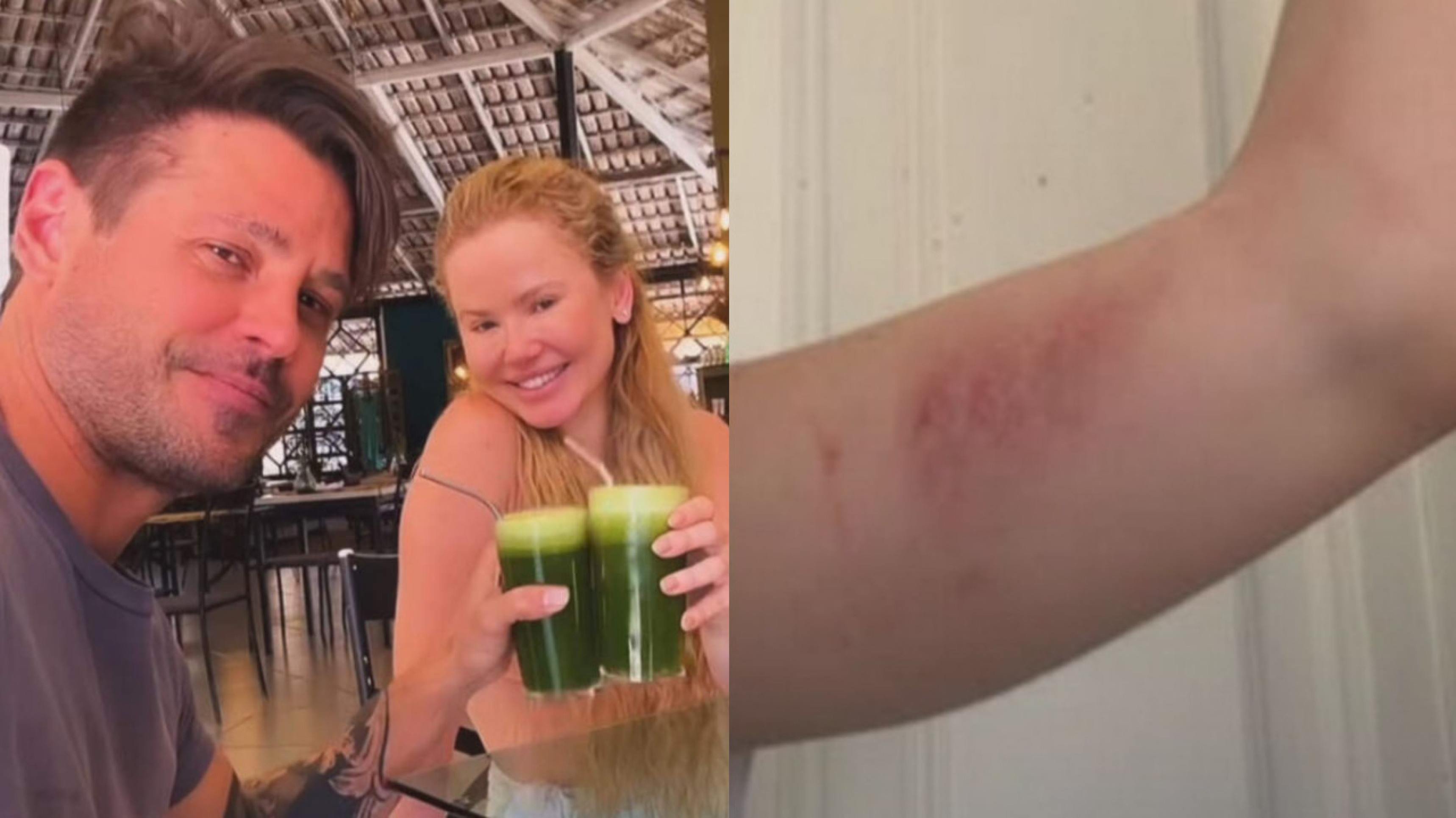 Miss Gramado foi coagida por Dado Dolabella a mentir sobre agressões