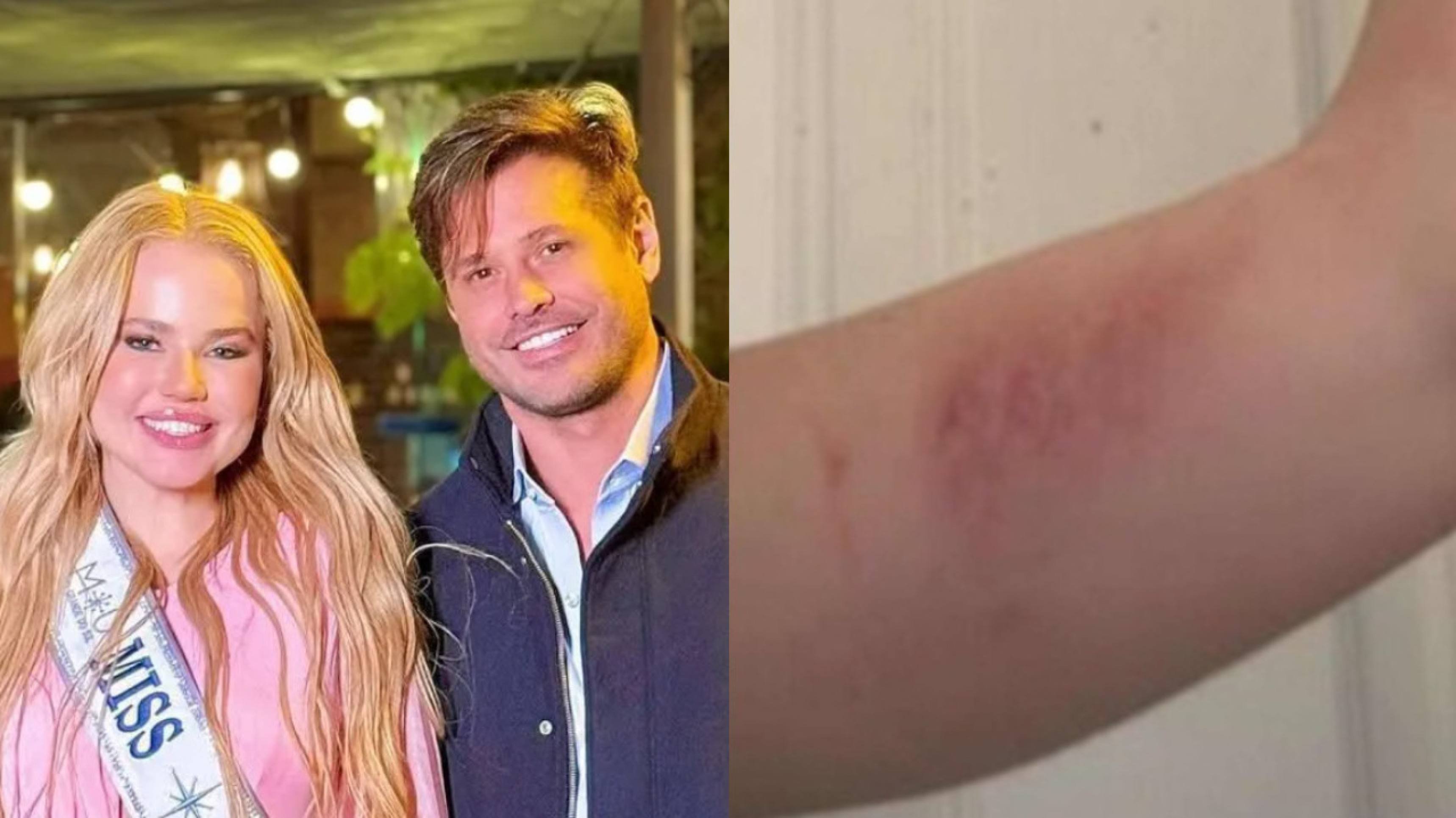 Marcela Tomaszewski assume mentira e confirma agressão de Dado Dolabella