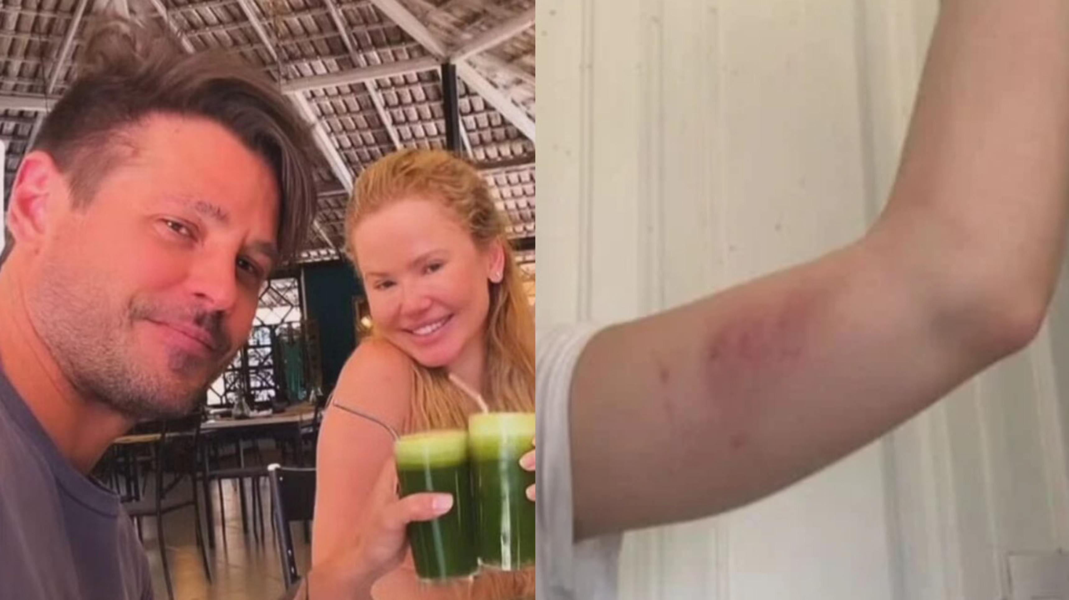 Namorada de Dado Dolabella reage à críticas sobre agressão e defende ator