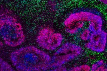Cientistas revelam mapas mais detalhados já feitos sobre o desenvolvimento do cérebro de mamíferos - (crédito: Nano et al./Nature Neurosci.; Jose Soto/Bhaduri Lab/UCLA) Cientistas revelam mapas mais detalhados já feitos sobre o desenvolvimento do cérebro de mamíferos - (crédito: Nano et al./Nature Neurosci.; Jose Soto/Bhaduri Lab/UCLA)