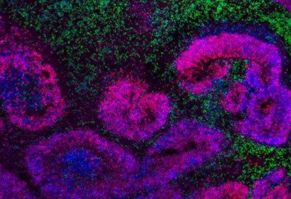 Cientistas revelam mapas mais detalhados já feitos sobre o desenvolvimento do cérebro de mamíferos -  (crédito: Nano et al./Nature Neurosci.; Jose Soto/Bhaduri Lab/UCLA) -Cientistas revelam mapas mais detalhados já feitos sobre o desenvolvimento do cérebro de mamíferos -  (crédito: Nano et al./Nature Neurosci.; Jose Soto/Bhaduri Lab/UCLA)