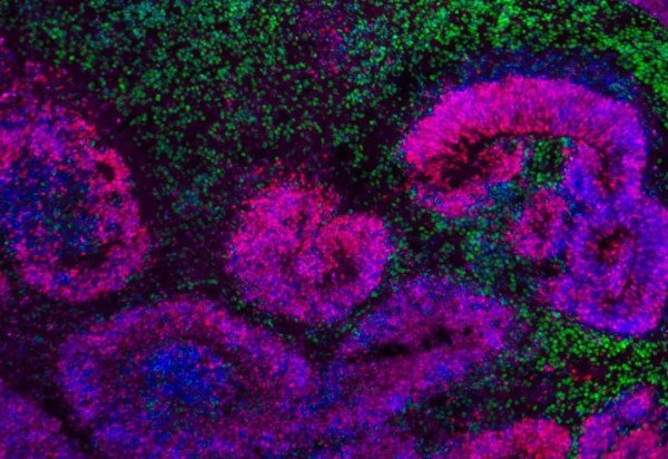 Nano et al./Nature Neurosci.; Jose Soto/Bhaduri Lab/UCLA