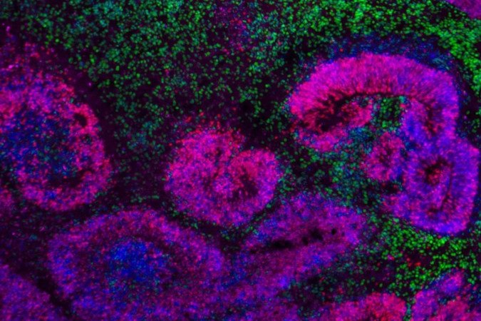 Cientistas revelam mapas mais detalhados já feitos sobre o desenvolvimento do cérebro de mamíferos - (crédito: Nano et al./Nature Neurosci.; Jose Soto/Bhaduri Lab/UCLA) Cientistas revelam mapas mais detalhados já feitos sobre o desenvolvimento do cérebro de mamíferos - (crédito: Nano et al./Nature Neurosci.; Jose Soto/Bhaduri Lab/UCLA)