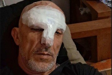 Cristian Cravinhos foi socorrido com ferimentos e elogiou a conduta dos policiais após o susto - (crédito: Reprodução / Instagram ) Cristian Cravinhos foi socorrido com ferimentos e elogiou a conduta dos policiais após o susto - (crédito: Reprodução / Instagram )