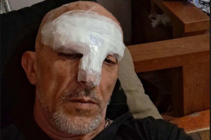 Coincidência? Irmão Cravinhos sofre acidente perto do local do crime