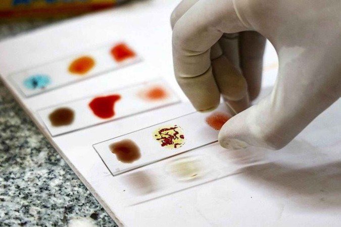 O sistema ABO é apenas um dentre diversos tipos de classificação do sangue -  (crédito: Getty Images)
