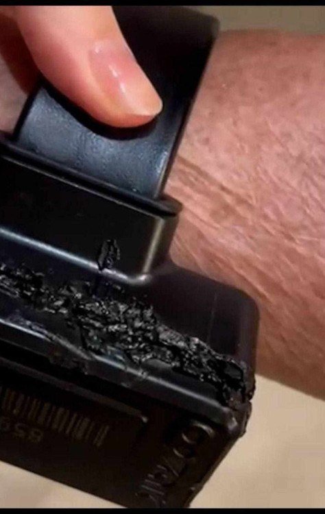 Bolsonaro diz que usou ferro de solda em tornozeleira: 'Curiosidade'