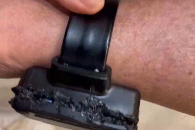 Imagens mostram tornozeleira de Bolsonaro com avarias -  (crédito: reprodução)