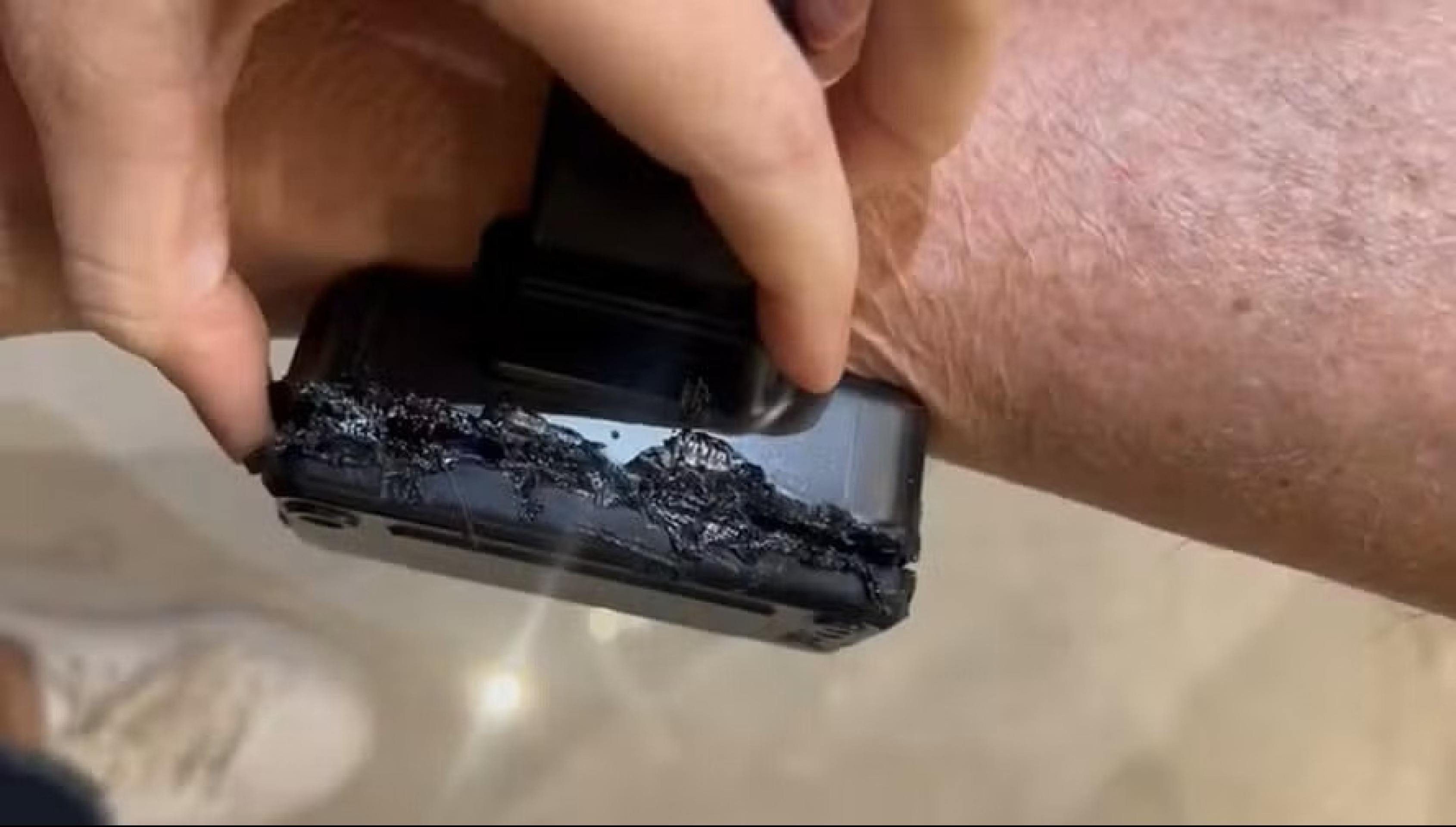 Bolsonaro culpa remédios por ter mexido em tornozeleira; psiquiatras falam em delírio