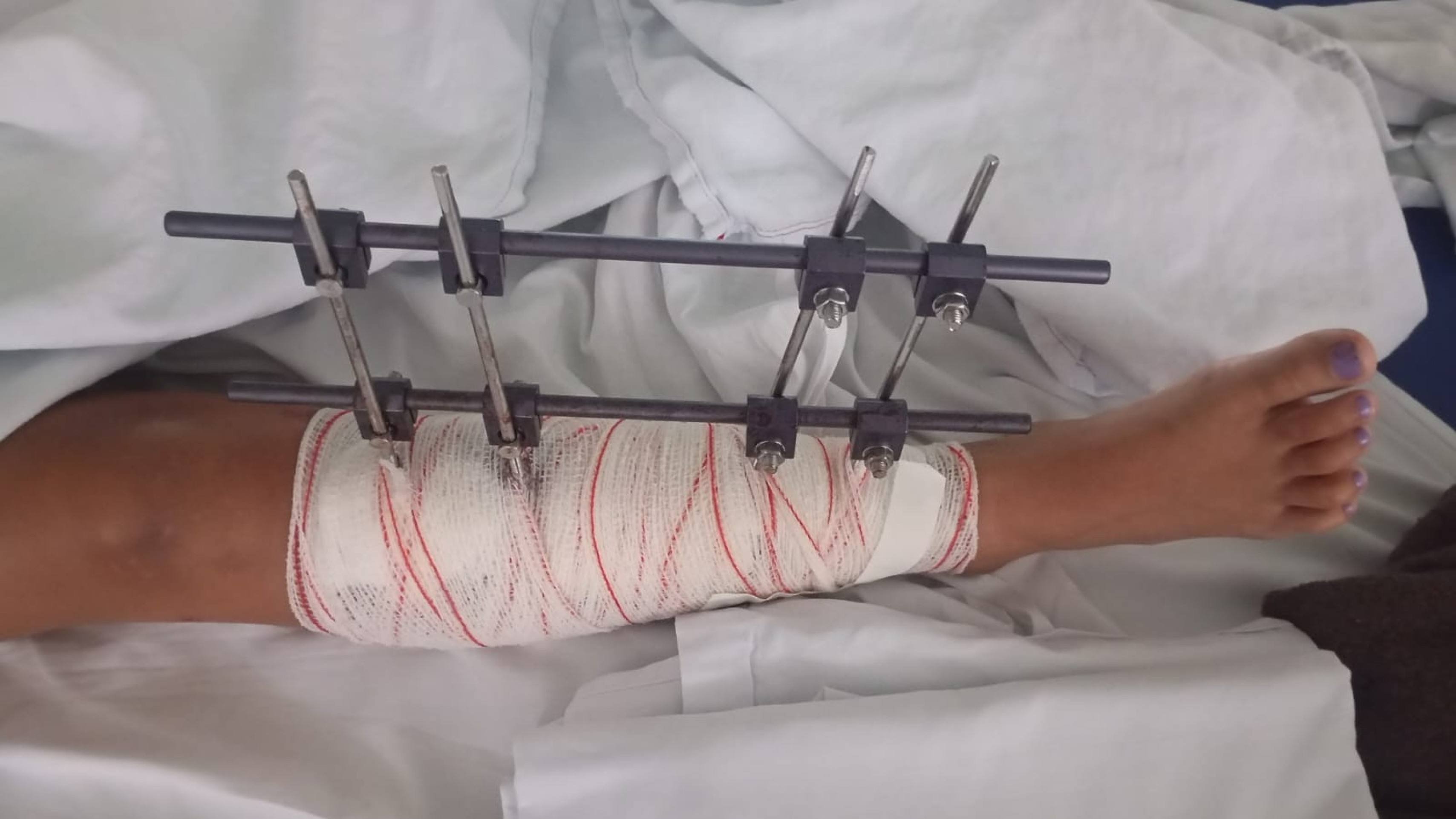 Motociclista foge após atropelar criança em Valparaíso (GO)