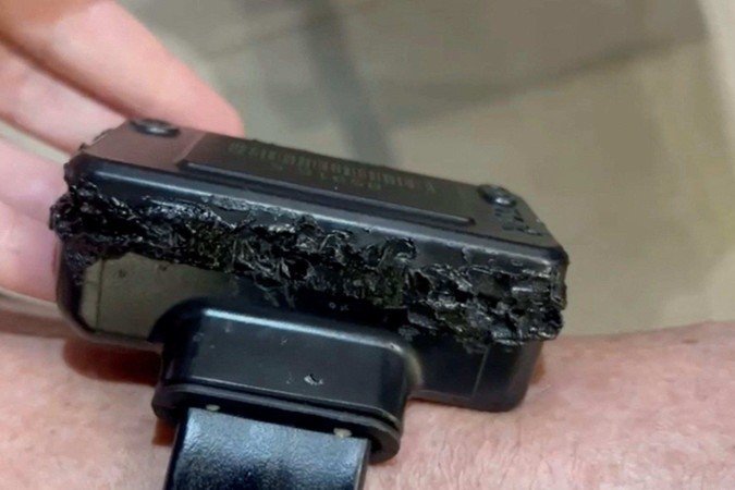 Cerca de 120 mil pessoas estão sob monitoramento eletrônico no Brasil - (crédito: Getty Images) Cerca de 120 mil pessoas estão sob monitoramento eletrônico no Brasil - (crédito: Getty Images)