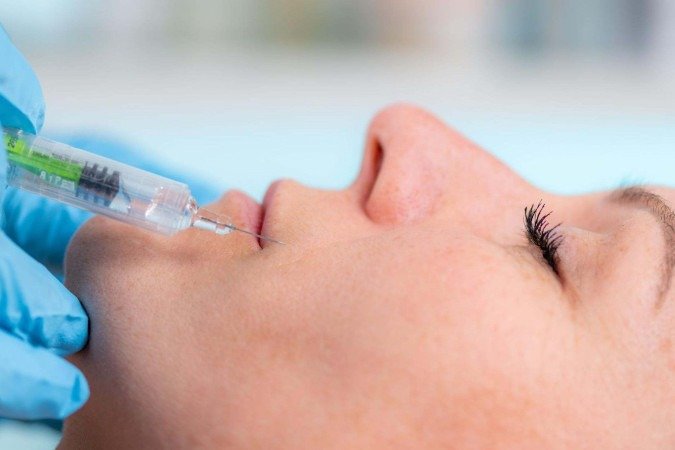 Um ultrassom dos lábios de um paciente mostra a ausência de fluxo sanguíneo  -  (crédito: Rosa Sigrist e RSNA)