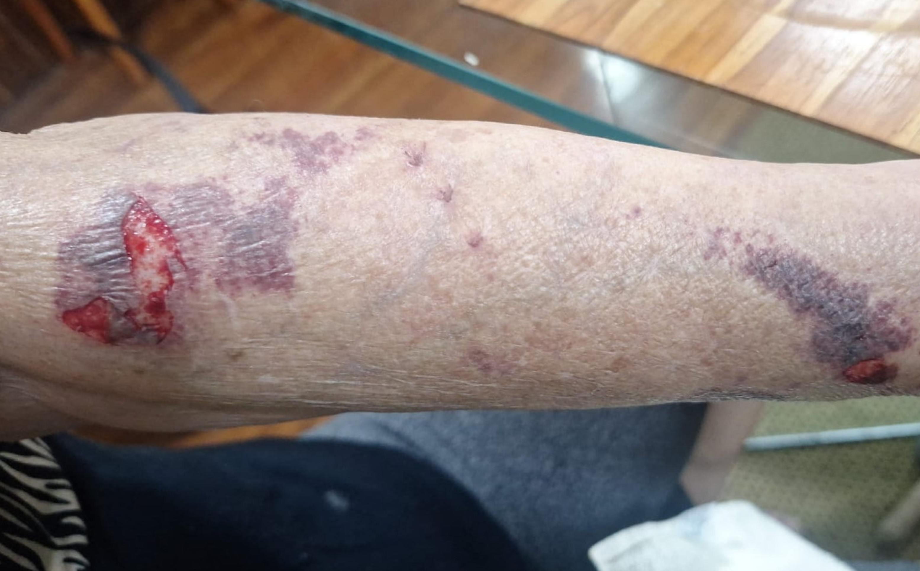 Fim de ano traz alerta de segurança para a Asa Norte