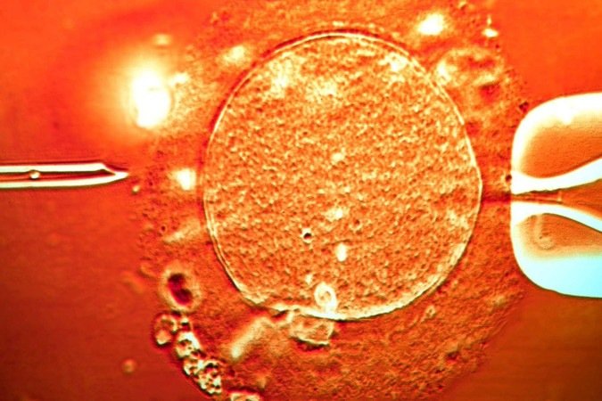 Até 20% do esperma do doador contém a mutação perigosa que aumenta o risco de câncer (imagem ilustrativa) - (crédito: Getty Images) Até 20% do esperma do doador contém a mutação perigosa que aumenta o risco de câncer (imagem ilustrativa) - (crédito: Getty Images)