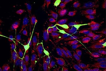 
Cancer cells (red, with their nuclei stained blue) grow thin tubes to siphon mitochondria out of nerve cells (green). Credit: Simon Grelet and Gustavo Ayala
