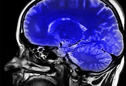 Em várias etapas da vida, o corpo humano deve receber nutrientes e vitaminas necessárias para o seu bom funcionamento. Assim, estudos demonstram que um composto orgânico pouco conhecido é fundamental para que o sistema nervoso humano fique saudável: Colina. -  (crédito: - Dominio Publico/hippopx.com) -Em várias etapas da vida, o corpo humano deve receber nutrientes e vitaminas necessárias para o seu bom funcionamento. Assim, estudos demonstram que um composto orgânico pouco conhecido é fundamental para que o sistema nervoso humano fique saudável: Colina. -  (crédito: - Dominio Publico/hippopx.com)