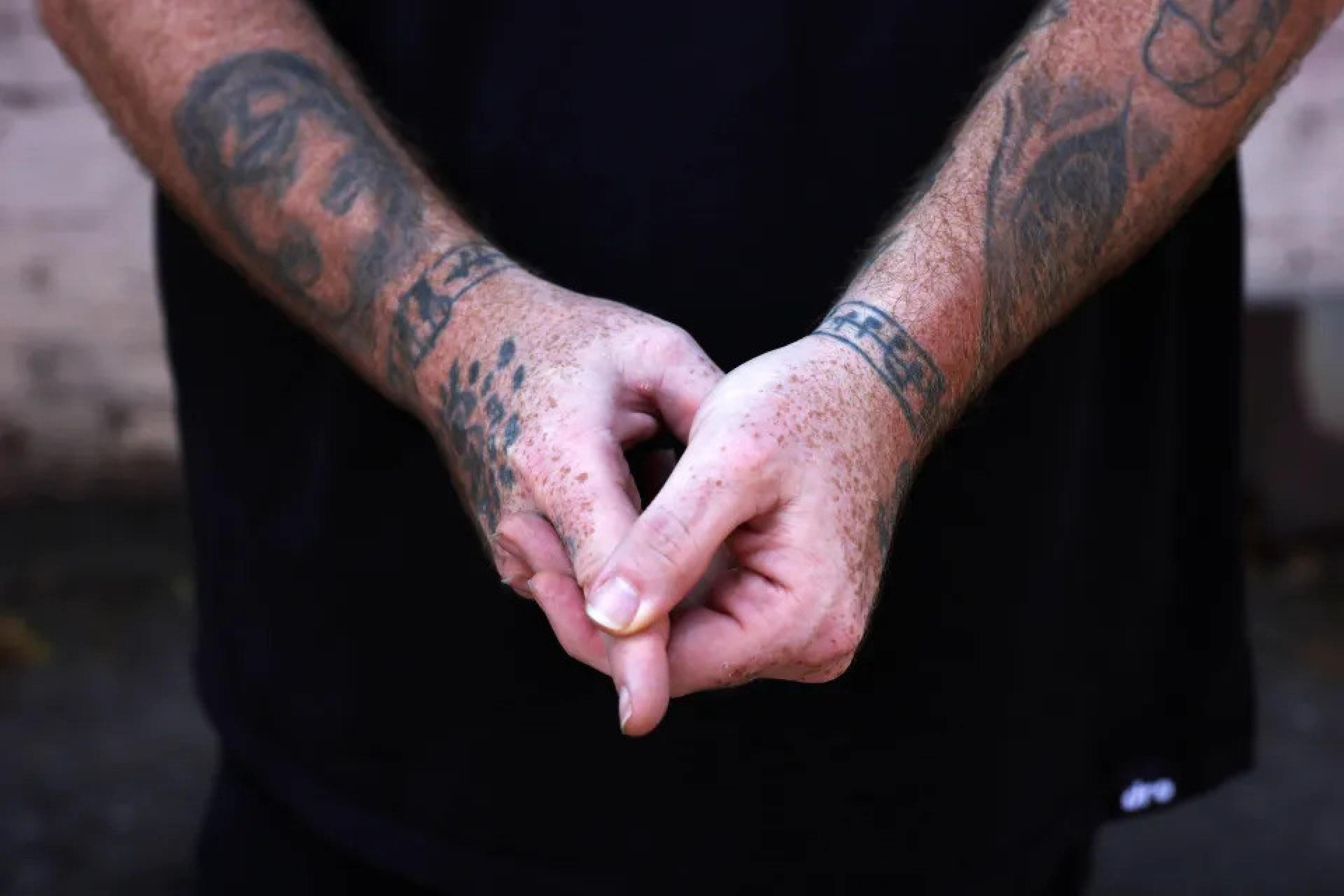 Michael Phillips, o homem com o menor p&ecirc;nis do mundo 