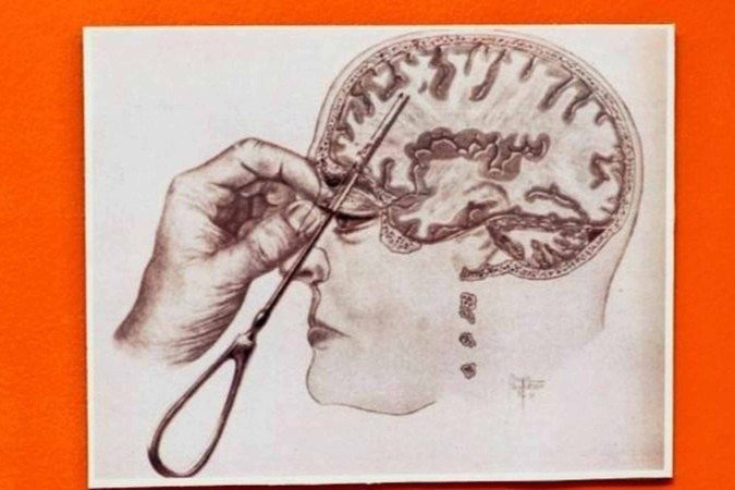 Sarah Paulson como a enfermeira Mildred em uma cena da série <em>Ratched</em> -  (crédito: Alamy)