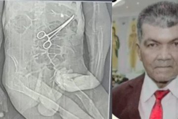 Idoso morre na véspera do Natal e família denuncia pinça esquecida dentro do corpo durante cirurgia em MG -  (crédito: Reprodução/Redes Sociais)