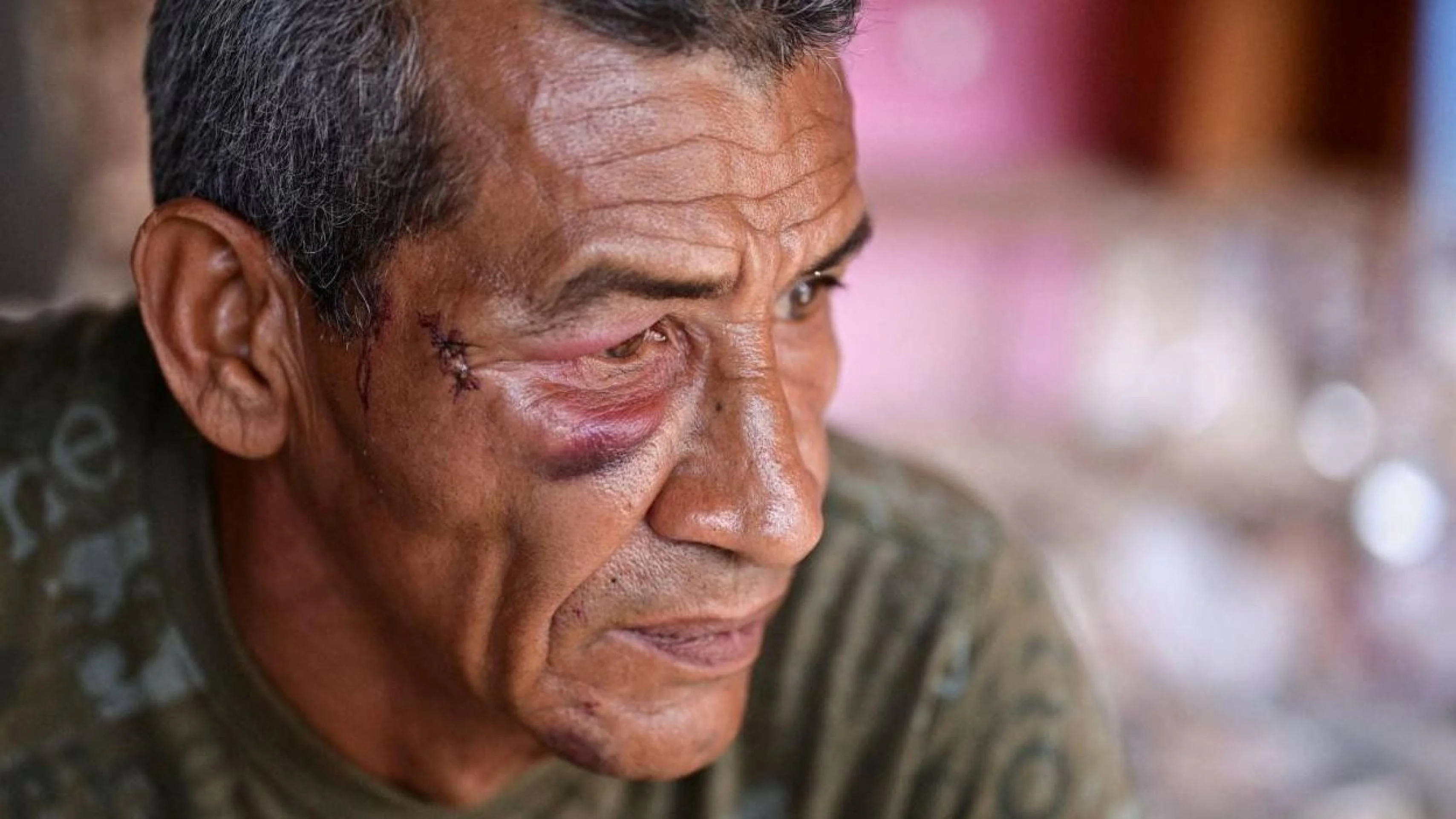 O Bloco 12, onde morreu Rosa González com o impacto de um míssil norte-americano -  (crédito: BBC)