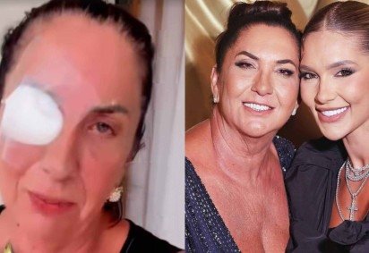 Mãe de Virginia surge com curativo no olho após término de namoro; saiba tudo! -  (crédito: Reprodução/Instagram) -Mãe de Virginia surge com curativo no olho após término de namoro; saiba tudo! -  (crédito: Reprodução/Instagram)