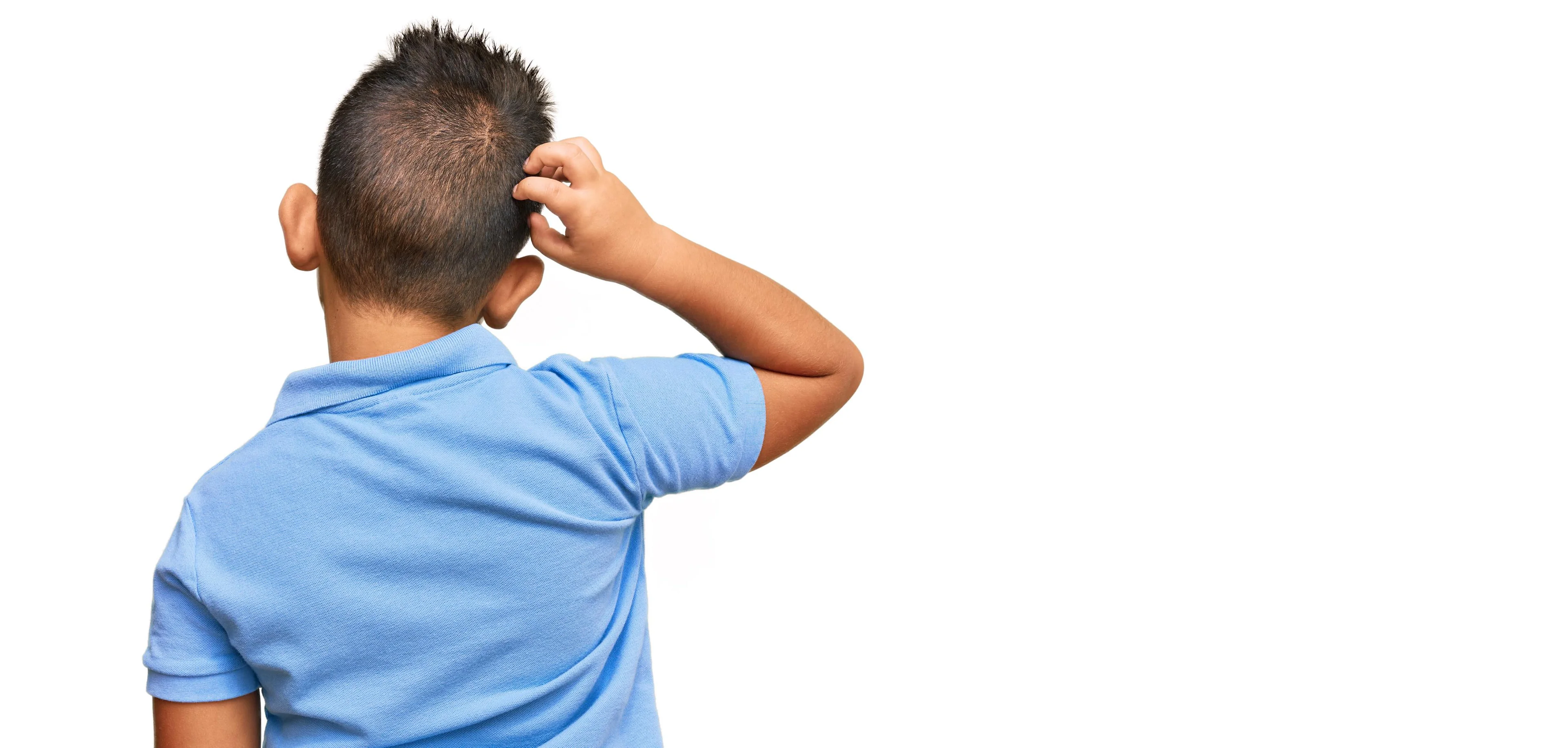 Pediculose: como tratar a infestação sem comprometer a saúde capilar