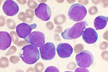 Muitas dessas enzimas sintetizam componentes essenciais da vida, e a localização nuclear delas está associada ao reparo do DNA -  (crédito:  VashiDonsk/Wikimédia Commons)