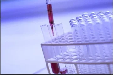  A biópsia líquida procura, no sangue, fragmentos do DNA do tumor. Quanto maior for o nível, menor a resposta ao tratamento -  (crédito:  Pexels/Divulgação)