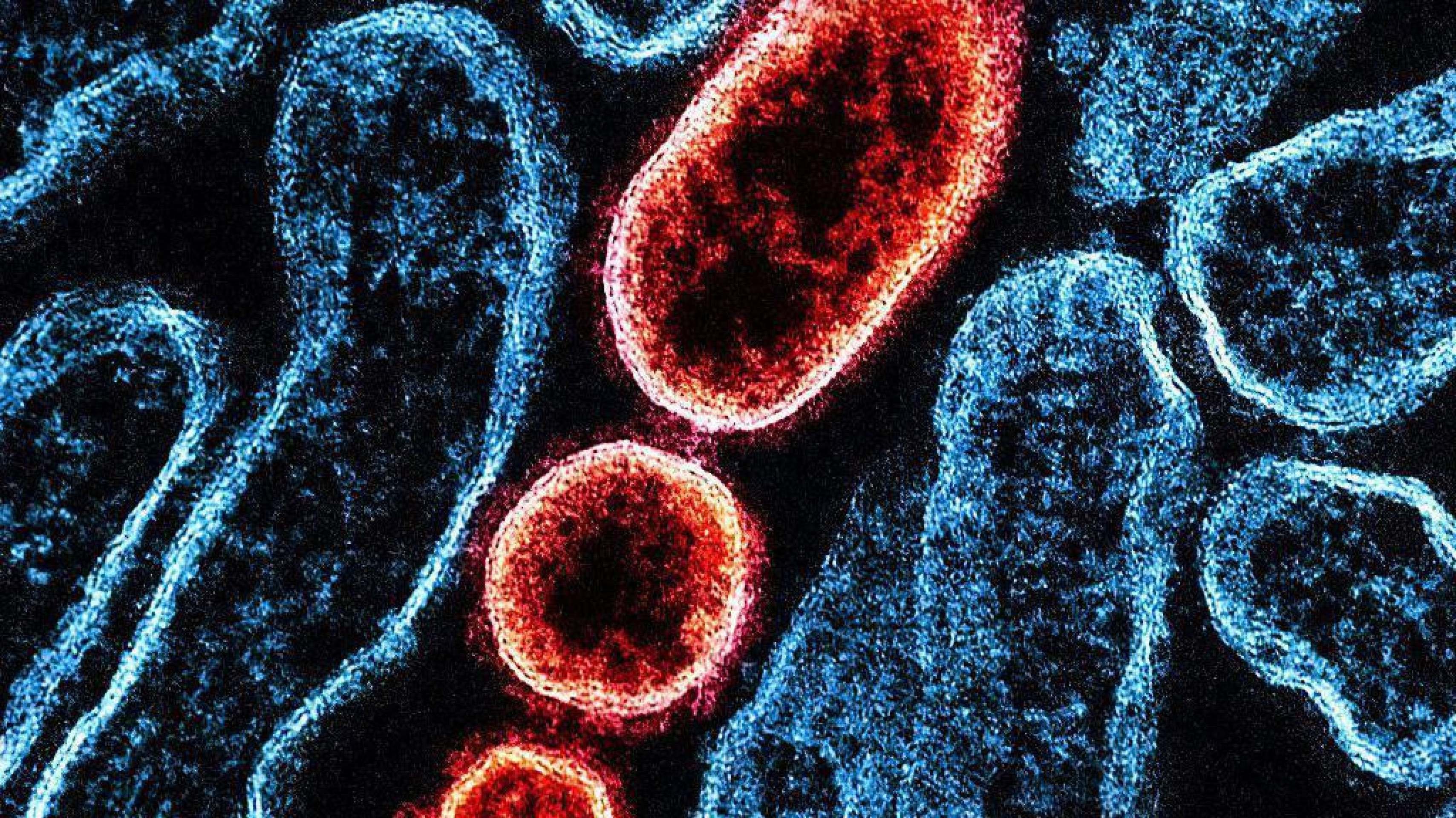 Morcegos podem transmitir o vírus - (crédito: Getty Images) Morcegos podem transmitir o vírus - (crédito: Getty Images)