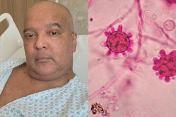 Fungo grave: Vocalista de banda famosa recebe alta após infecção no pulmão - (crédito: Reprodução/Instagram) Fungo grave: Vocalista de banda famosa recebe alta após infecção no pulmão - (crédito: Reprodução/Instagram)