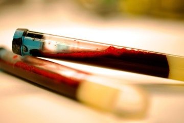 Amostra de sangue preparada para um exame laboratorial - (crédito: Nicola Pietro Montaldo) Amostra de sangue preparada para um exame laboratorial - (crédito: Nicola Pietro Montaldo)