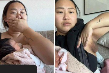 Mudanças hormonais da gravidez levaram mulher a desenvolver mamilo extra na axila -  (crédito: TikTok / reprodução)