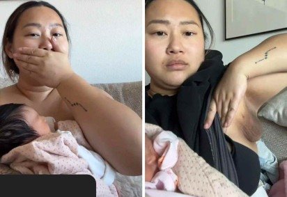 Mudanças hormonais da gravidez levaram mulher a desenvolver mamilo extra na axila -  (crédito: TikTok / reprodução) -Mudanças hormonais da gravidez levaram mulher a desenvolver mamilo extra na axila -  (crédito: TikTok / reprodução)
