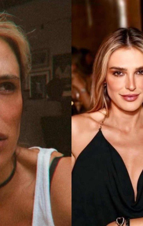 Rafa Brites descobre doença crônica e faz desabafo na web -  (crédito: Reprodução/Instagram)