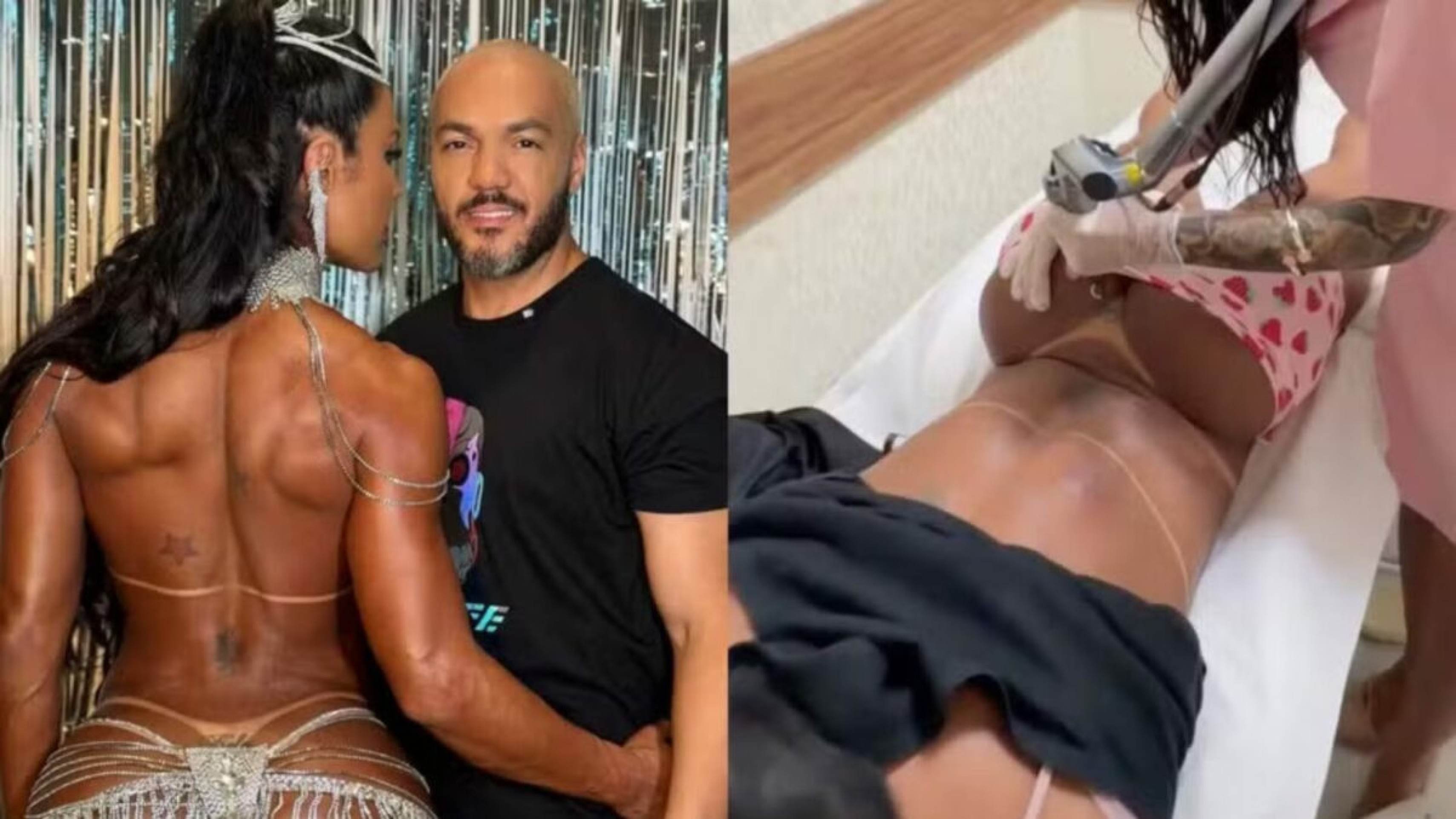 Gracyanne inicia retirada de tatuagem íntima dedicada para Belo -  (crédito: Observatorio dos Famosos)