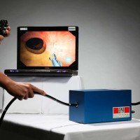                  No Brasil, o exame de colonoscopia   
           é indicado para pessoas entre 45 e 
      50 anos, mas pode ser feito mais cedo 
 no caso de fatores de risco importantes -  (crédito: Wikimedia Commons/Divulgação )