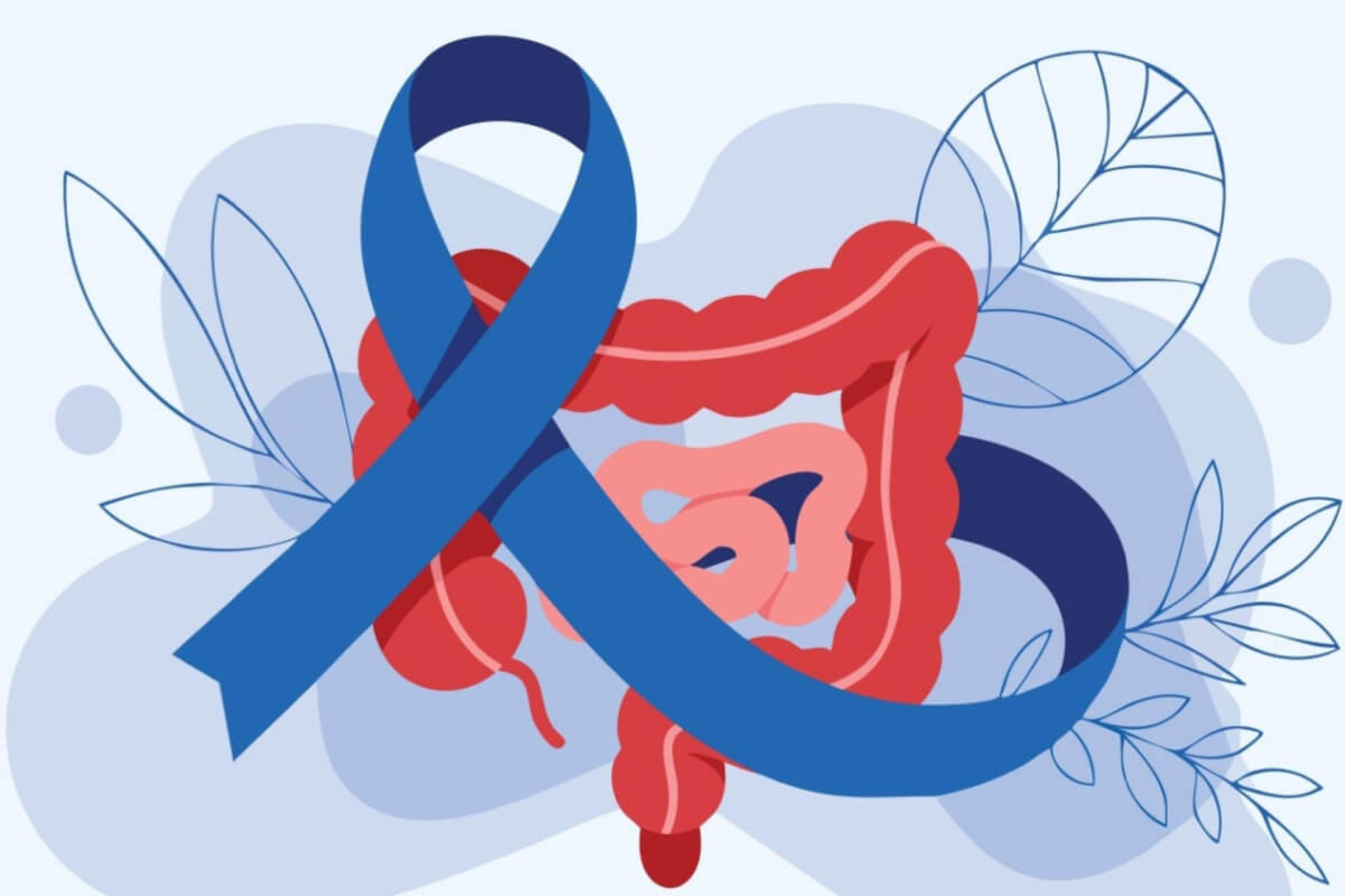 A atividade física é uma aliada contra o câncer colorretal (Imagem: Nasly creativity | Shutterstock) - (crédito: EdiCase) A atividade física é uma aliada contra o câncer colorretal (Imagem: Nasly creativity | Shutterstock) - (crédito: EdiCase)