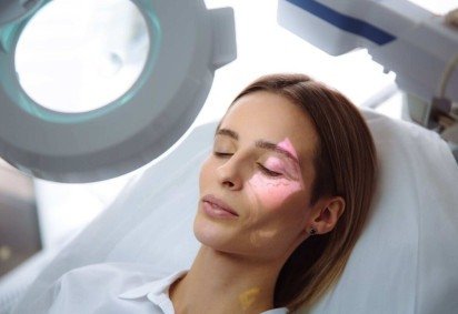 Vasinhos no rosto são comuns, mas suas causas ainda geram dúvidas (Imagem: Romano | Shutterstock)
 -  (crédito: EdiCase) -Vasinhos no rosto são comuns, mas suas causas ainda geram dúvidas (Imagem: Romano | Shutterstock)
 -  (crédito: EdiCase)